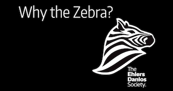EDS Zebra Logo